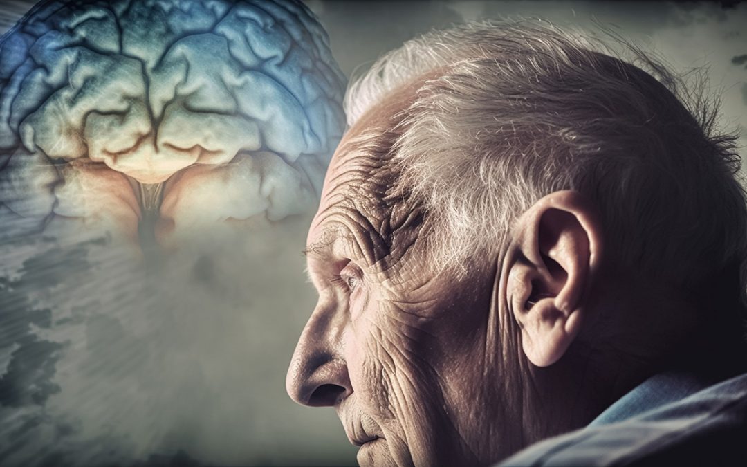 Vascular dementia: what is it, and what causes it?